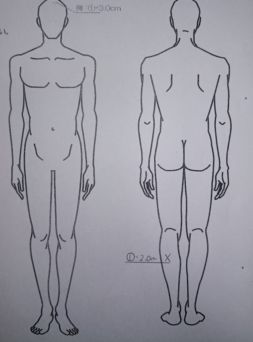 FELLOW セミドライウエットスーツ５ｘ３ｍｍ　バックジップ　サイズ　MLB　未使用　訳あり_画像8