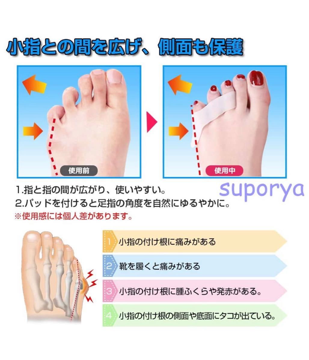 Paypayフリマ 内反小趾 サポーター Paypayフリマ 内反小趾 サポーター