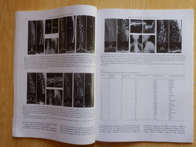 【2冊】THE SPINE JOURNAL SEPTEMBER 2020 VOLUME 20 NUMBER 9/9S North American Spine Society（北米脊椎学会 ）