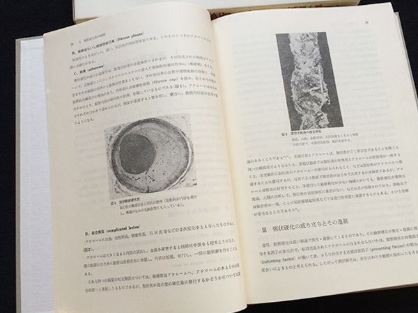 動脈硬化症の新しい診断と治療■五島雄一郎/後藤由夫@1985年/医薬ジャーナル社_画像2