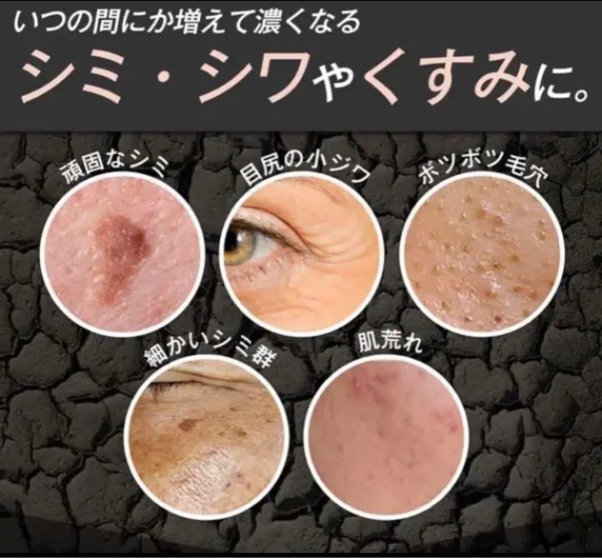 Paypayフリマ ツヤツヤ 美白 シミ 毛穴もビックリ リッチ ビタミンc 美容液 2本 ニキビ Paypayフリマ ツヤツヤ 美白 シミ 毛穴もビックリ リッチ ビタミンc 美容液 2本 ニキビ