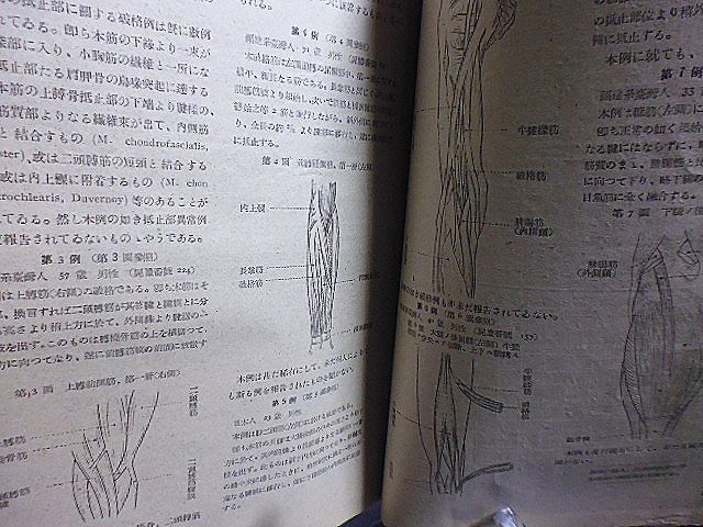 台湾医学会雑誌　42巻10－11号　キニーネ習慣作用ニ関スル実験的研究　アンボン人ノ生体人類学的研究　慢性マラリア　精神分裂病_画像5