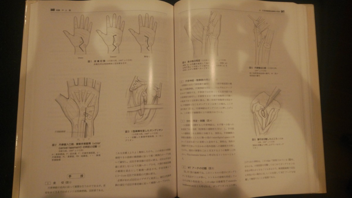 整形外科手術クルズス 医学書 整形外科 書籍 教科書 オペ看護師 整形外科手術クルズス 医学書 整形外科 書籍 教科書 オペ看護師