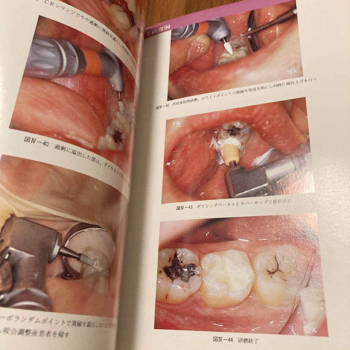 高価歯科学書　臨床カラーシリーズ