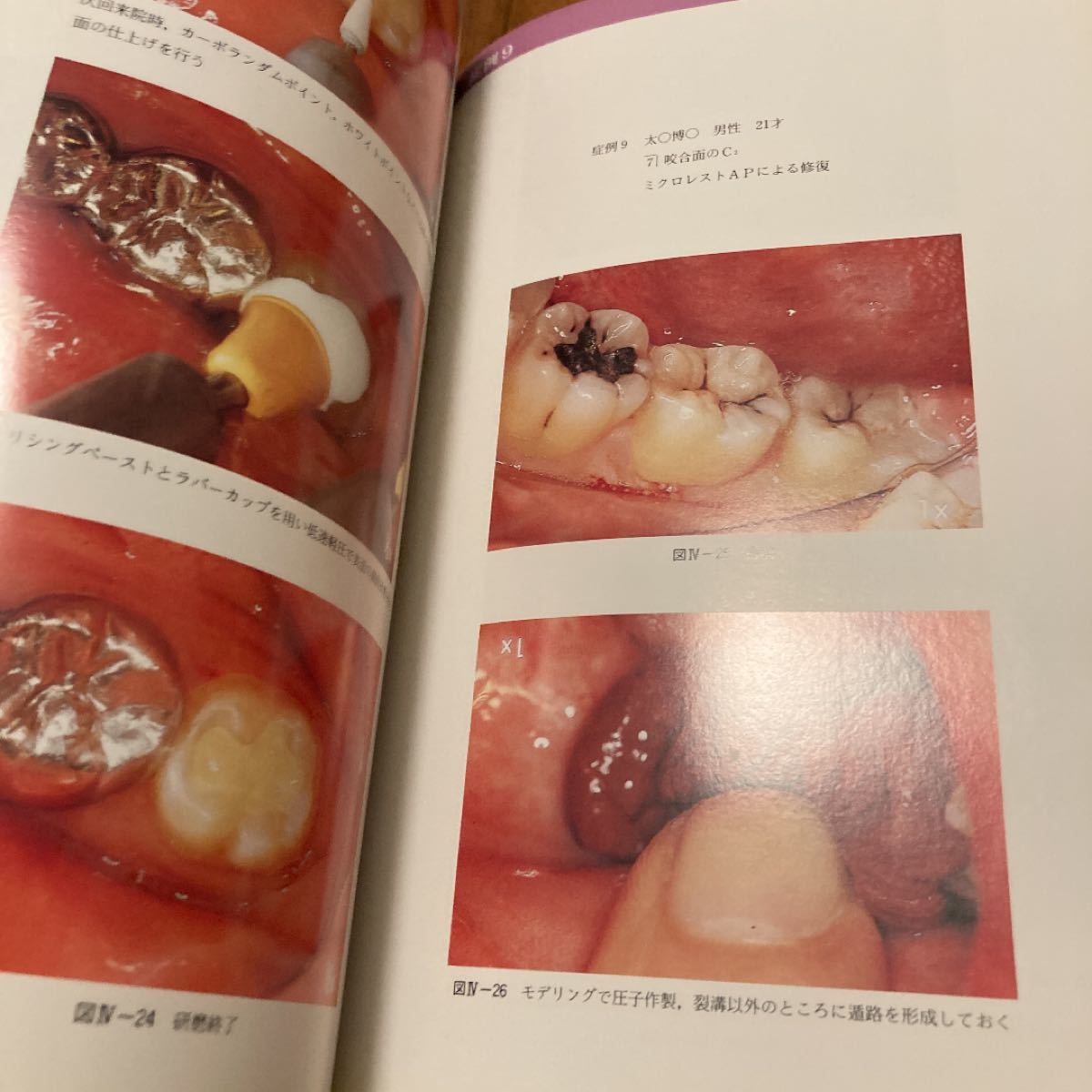 高価歯科学書　臨床カラーシリーズ