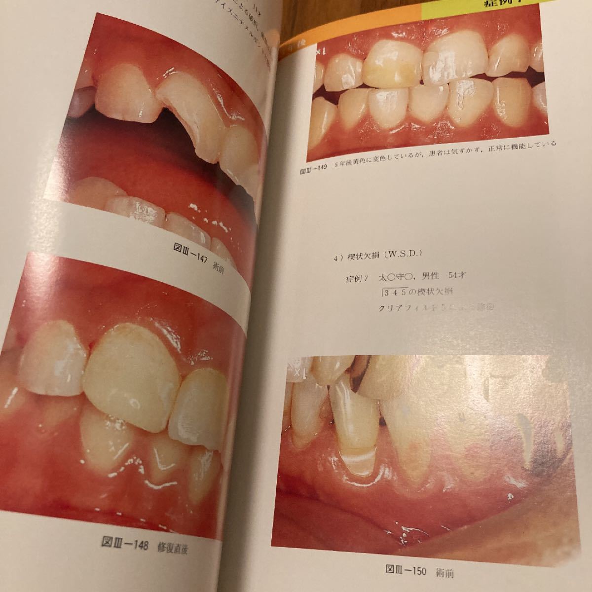 高価歯科学書　臨床カラーシリーズ