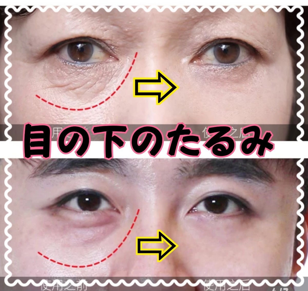 Paypayフリマ ビッグサイズ 目の下のたるみシワ改善クリーム おでこや首のシワにも Paypayフリマ ビッグサイズ 目の下のたるみシワ改善クリーム おでこや首のシワにも