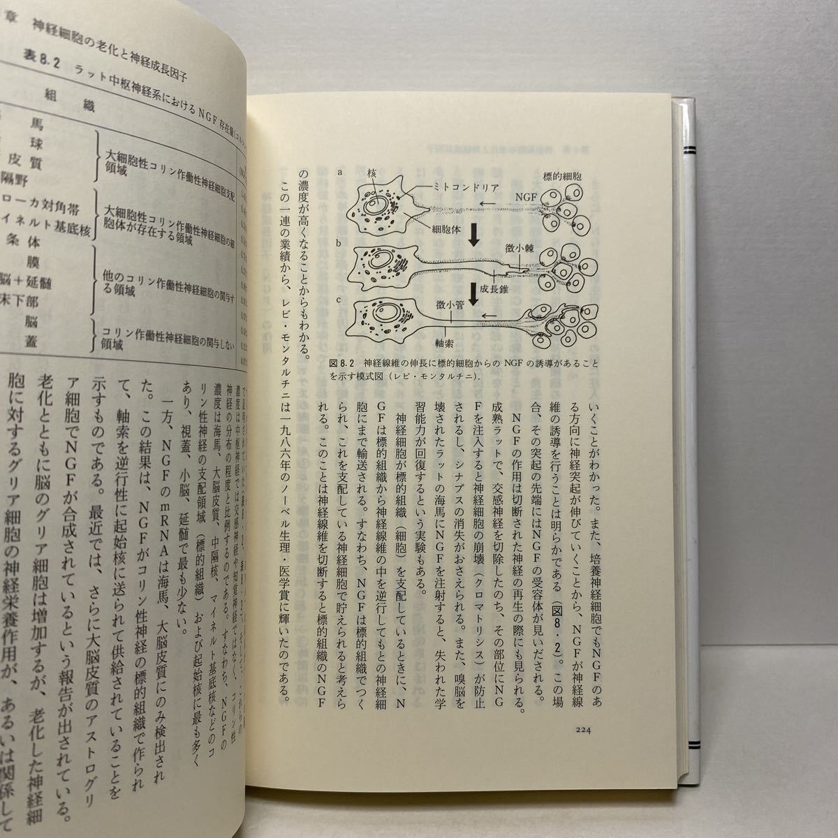 ア5/脳の老化とぼけ 朝長正徳 紀伊國屋書店 1988年 単行本 送料180円（ゆうメール）_画像5