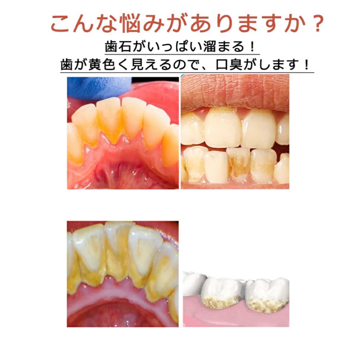 【5／21限定お値下げ】電動歯ブラシ 歯石取り 充電式 口腔ケア 音波振動歯ブラシ