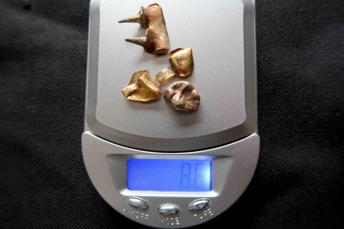 歯科用金属 合計 約27.8g(金歯、銀歯、パラジューム、金パラ、合金 他) ※入歯用_画像2