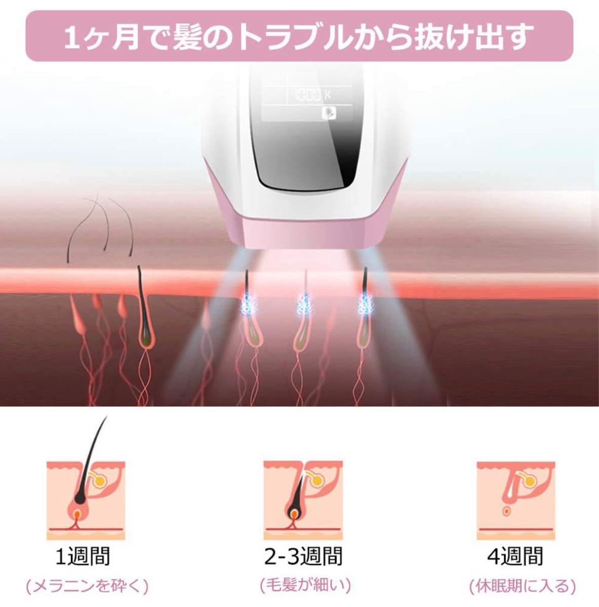 脱毛器 IPLレーサー 光脱毛器全身ムタ毛処理無痛脱毛 100万回照射