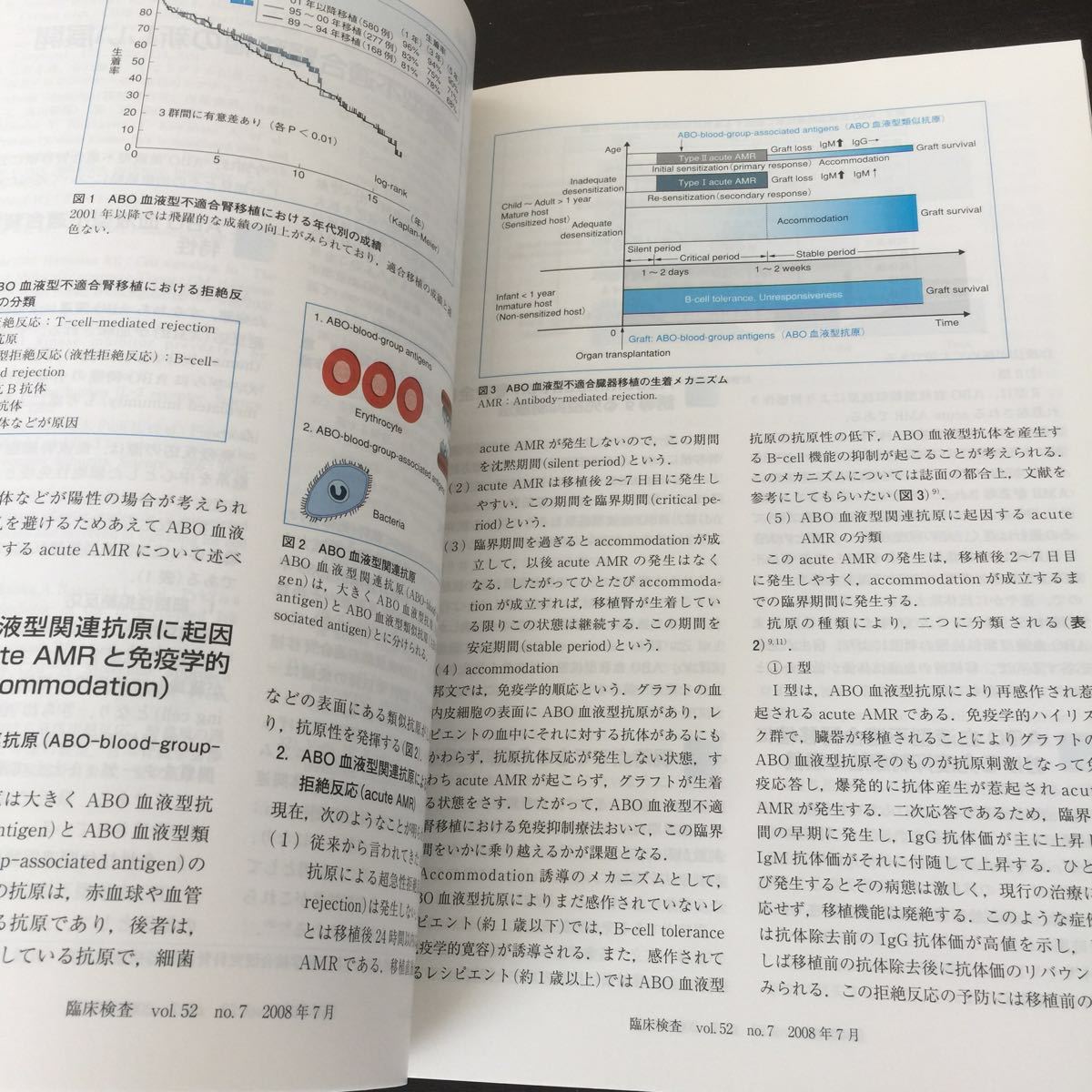 あ49 臨床検査 賢移植 2008年7月号 医学書院 病気 医者 免疫 医学 治療 血液型 手術 ドナー 糖尿病 合併症 賢移植手術 賢再生 レシピエント_画像9