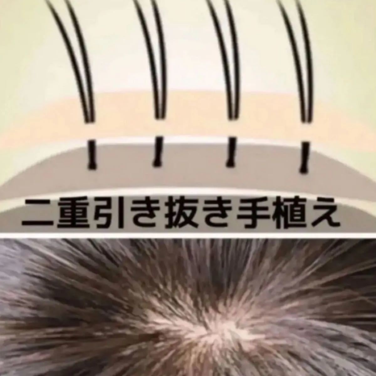 スーパーワイドヘアピース高級人毛100%リアル頭皮二重引き抜き総手植え