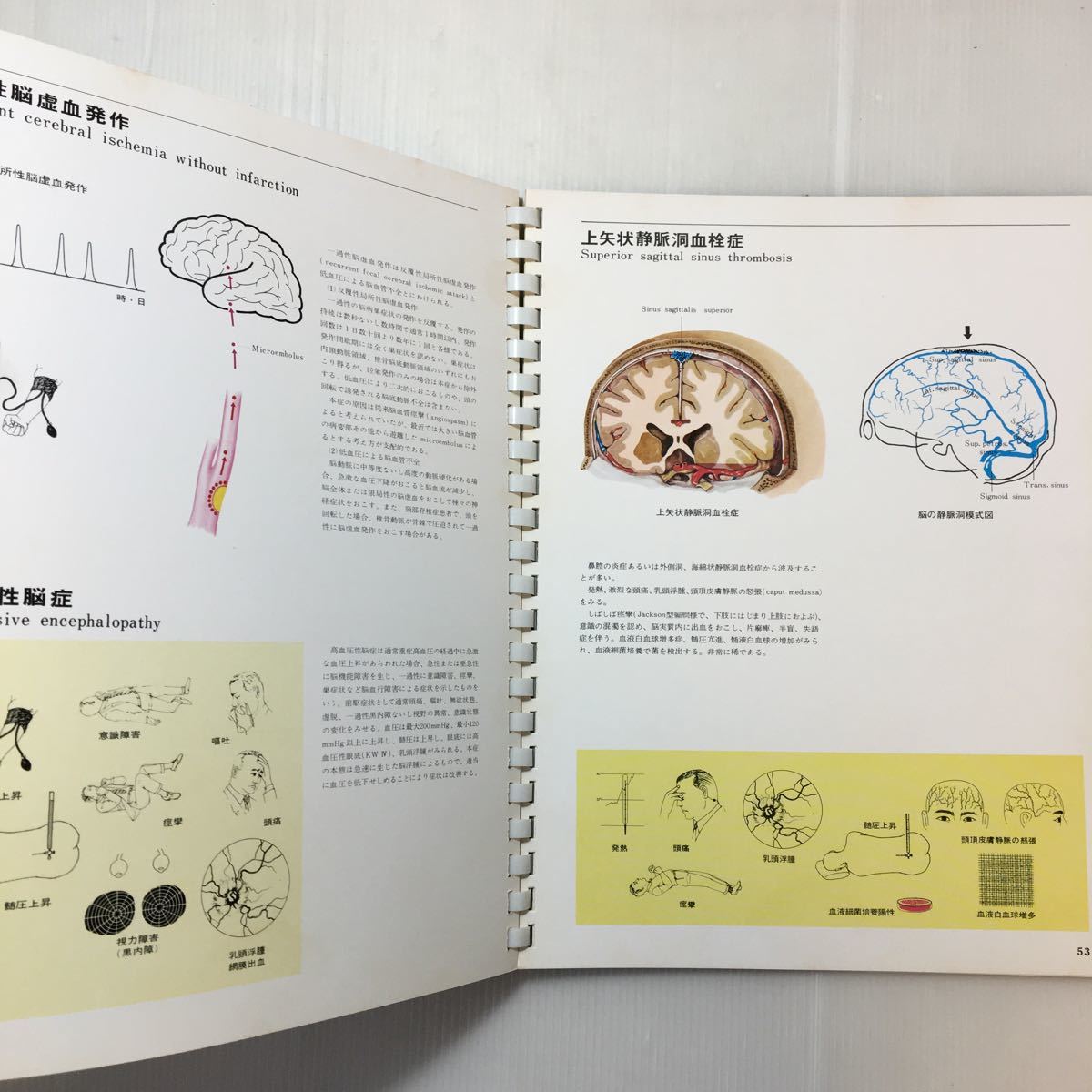 zaa-200♪目で見る脳血管障害　慶応大学医学部内科　相澤豊三・後藤文男　1967年　武田製薬(発行)