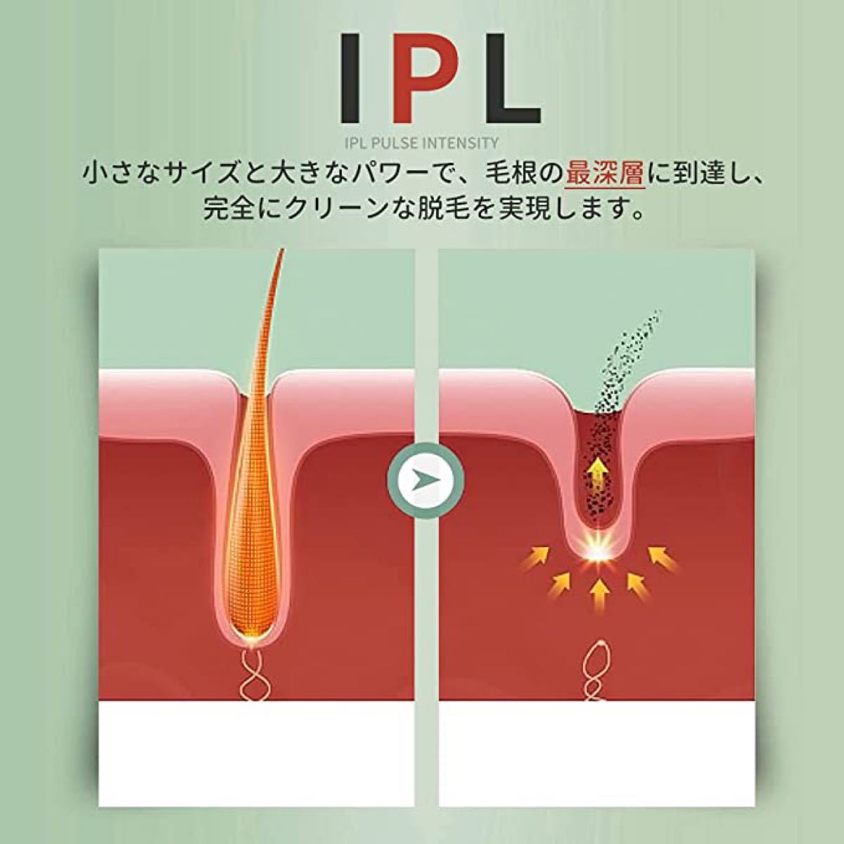 脱毛器 ipl光脱毛器 家庭用脱毛器 VIO対応 全身脱毛 99万回照射