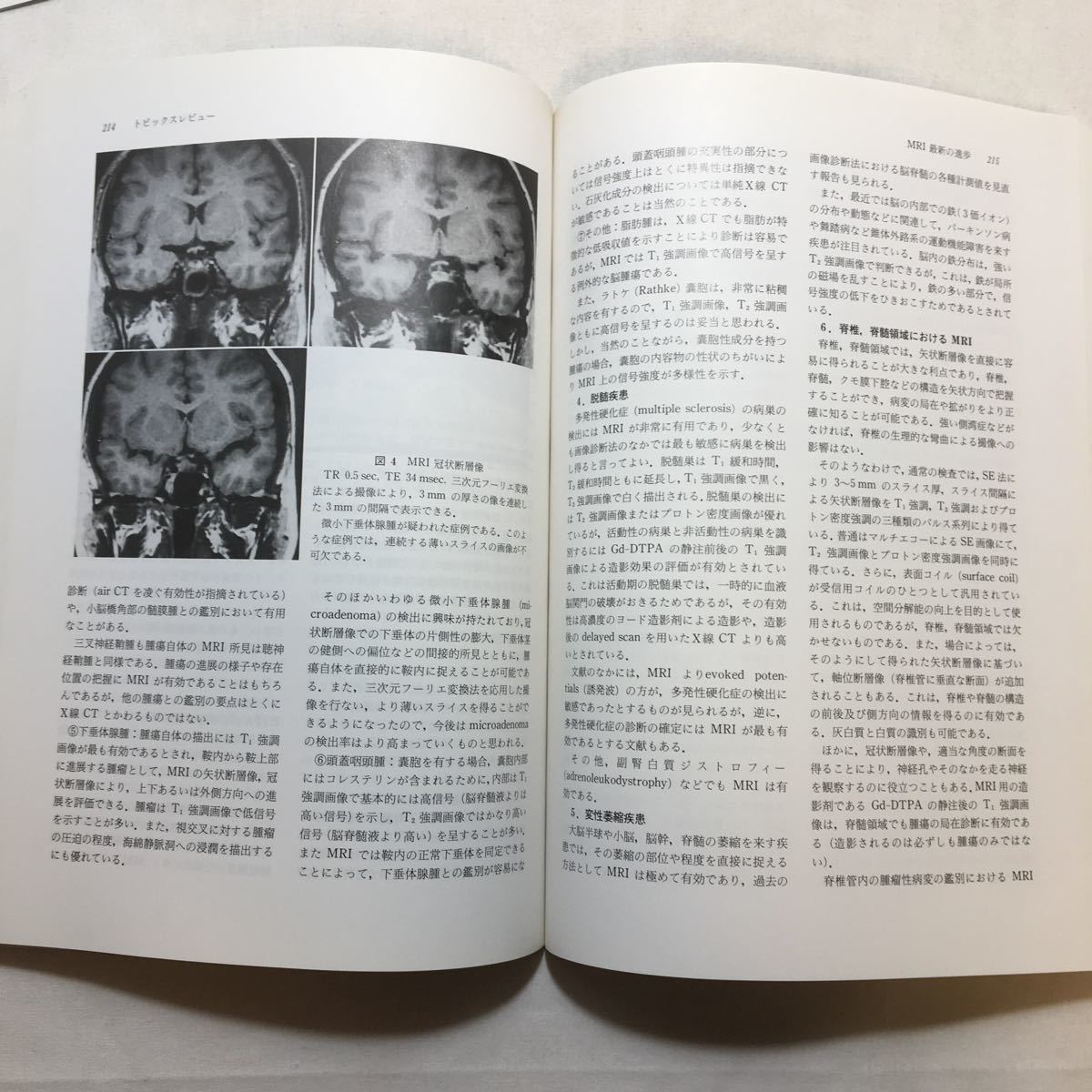 zaa-377 神経科学レビュー 2 楢林博太郎 (著) 伊藤正男 (著 zaa-377 神経科学レビュー 2 楢林博太郎 (著) 伊藤正男 (著