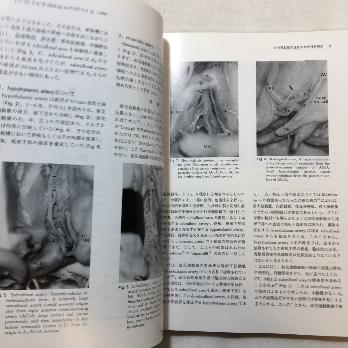 zaa-226♪Willis動脈輪の血管病変 －微小解剖から最先端治療まで－斉藤勇(監修)株式会社にゅーろん社(刊) 1994年