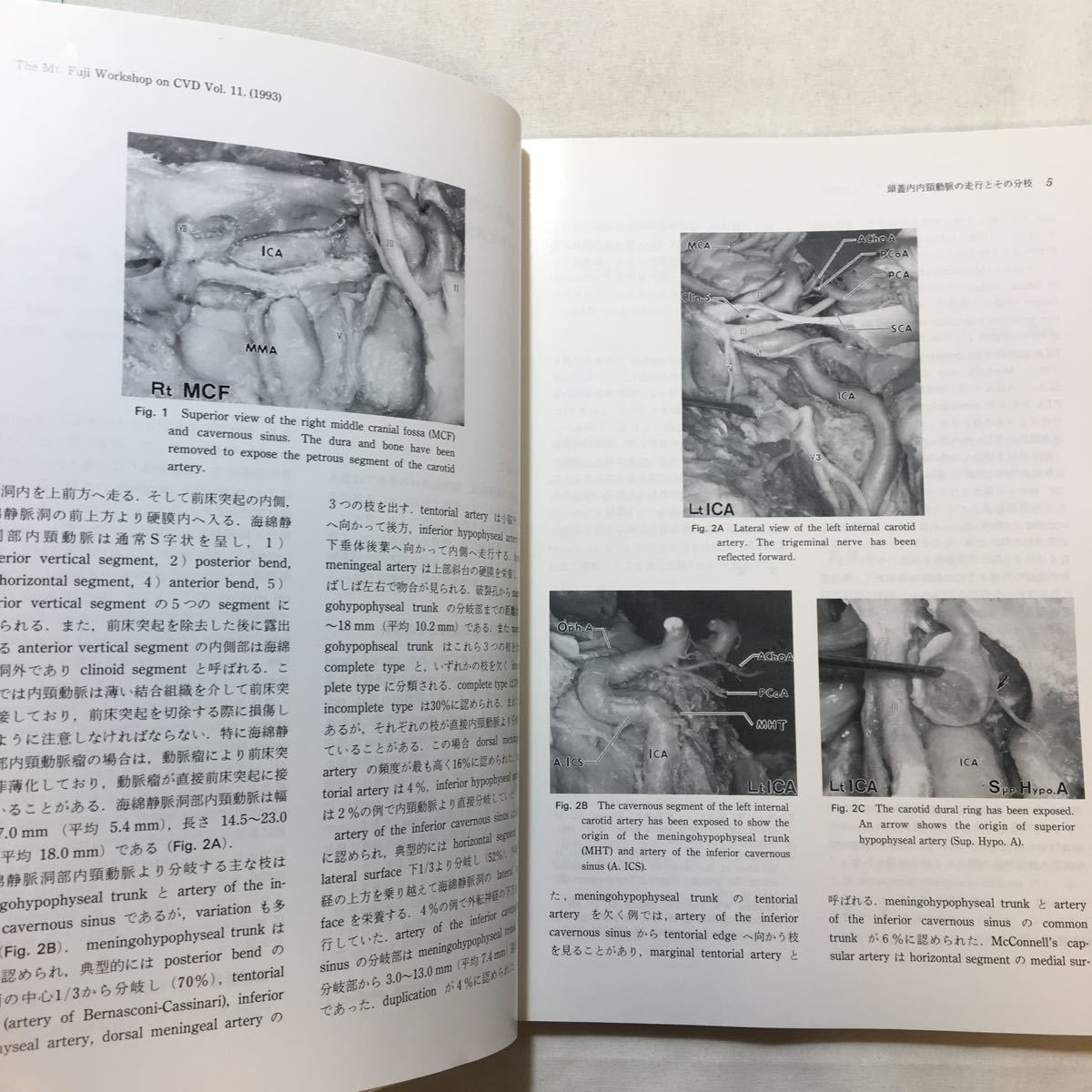 zaa-226♪内頸動脈瘤のすべて －微小解剖から最先端治療まで－斉藤勇(監修)株式会社にゅーろん社(刊) 1993年