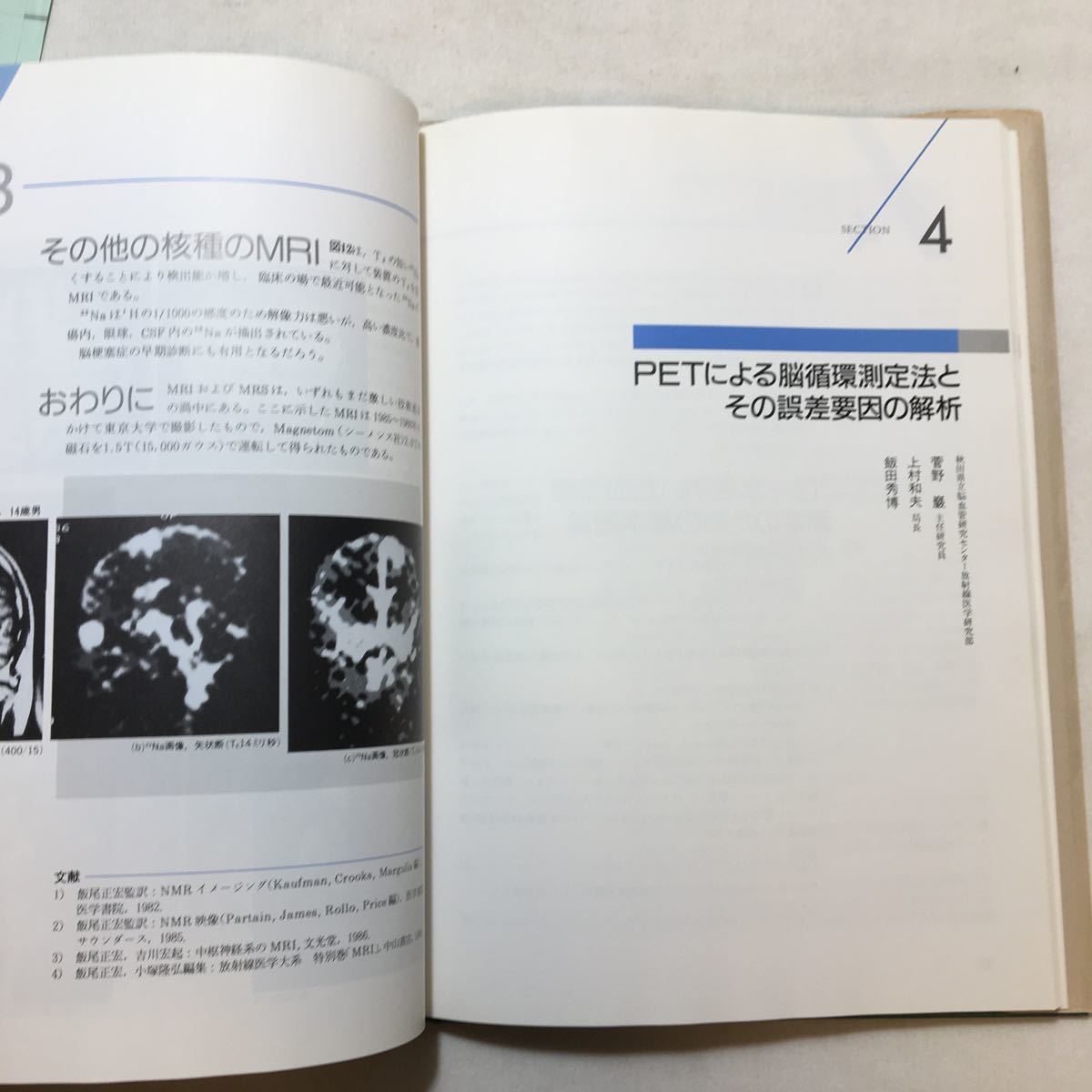 zaa-226♪脳疾患の新しい臨床診断法－その効用と限界 後藤文男(編) 中外製薬株式会社(刊) 1988年 非売品