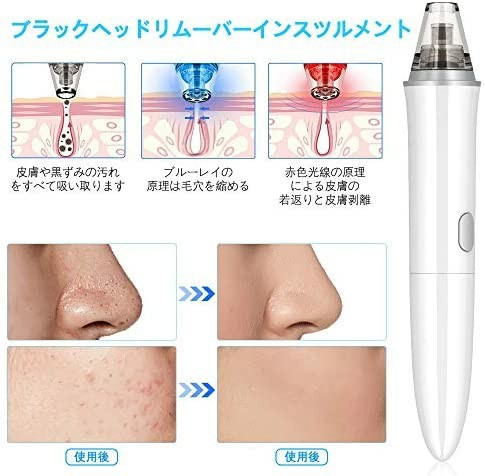 【新品未使用】毛穴吸引器 鼻黒ずみ吸引 毛穴ケア美顔器 毛穴黒ずみ取り 3段階吸引力 5種類吸引ノズル ニキビ吸引 黒ずみ取り