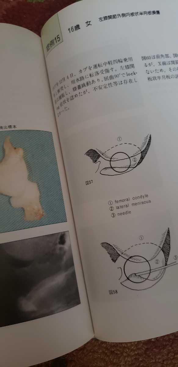 非売品〉関節鏡視と関節造形 渡辺正穀1985【管理番号医学cp本1130】 - 医学一般 非売品〉関節鏡視と関節造形 渡辺正穀1985【管理番号医学cp本1130】 - 医学一般