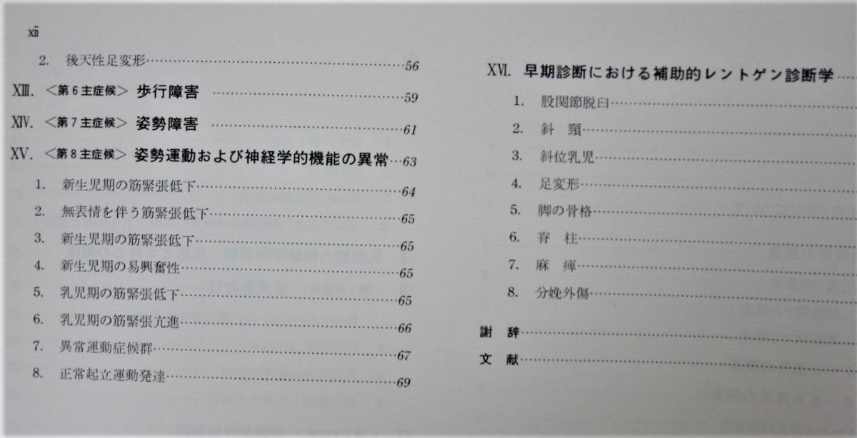 小児運動器疾患の早期診断法■R.Bernbeck, A.Sinios/鈴木良平■医歯薬出版/昭和52年/初版_画像3