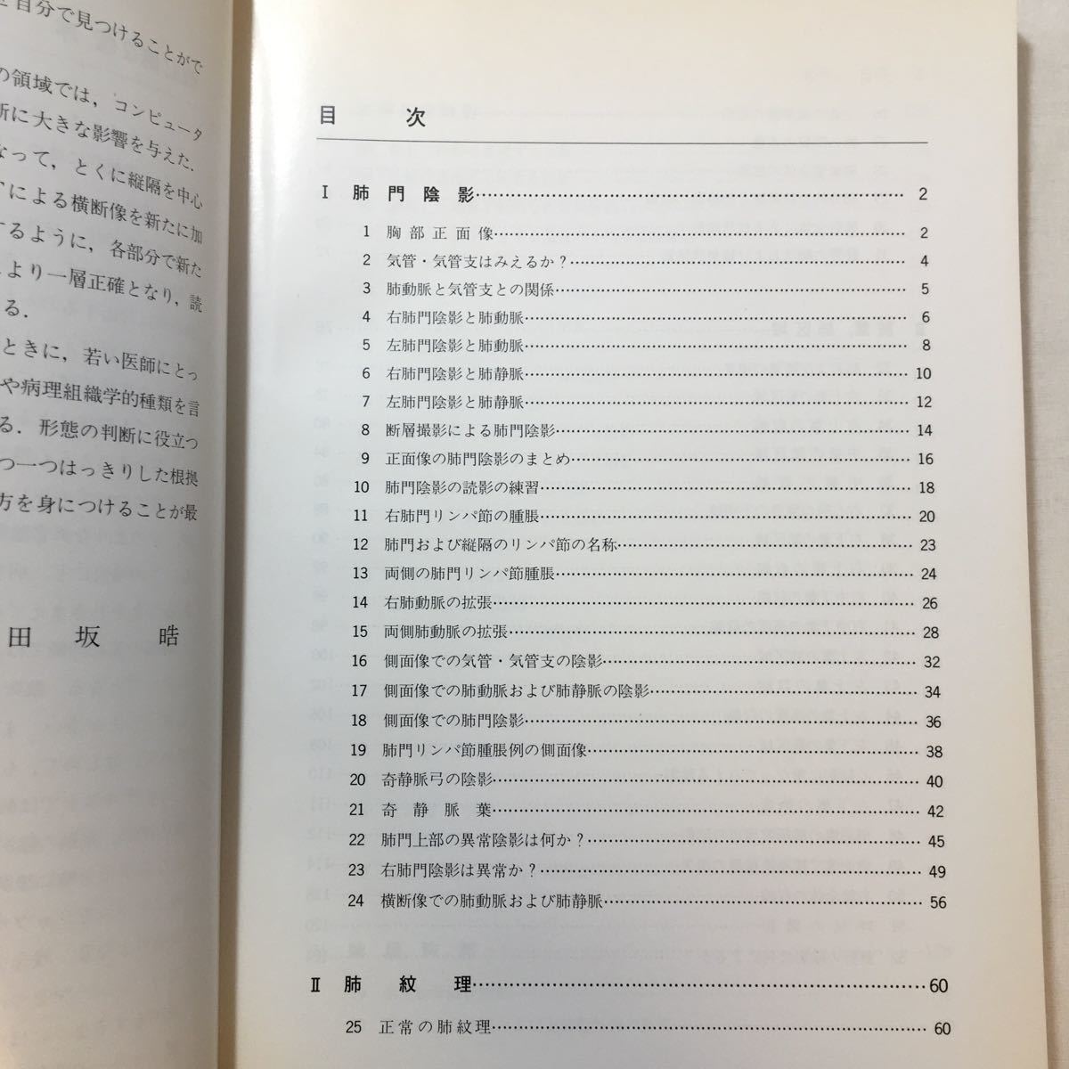 zaa-254♪胸部X線読影テキスト 単行本 1980/2/1 田坂晧 (著)　文光堂_画像2