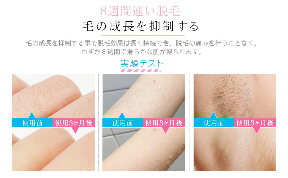 2021人気No.1の IPL 脱毛器 無痛 光脱毛 男女兼用 VIO 99万回照射 ...