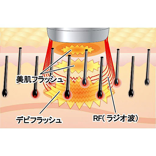 脱毛器 ハイパワーワイドフラッシュエステ キセノンフラッシュ ムダ毛ケア_画像5