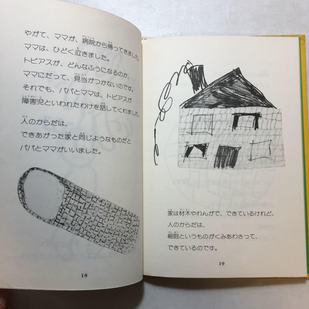 zaa-267♪わたしたちのトビアス (障害者を理解する本) 単行本 1978/9/1 セシリア・スベドベリ (編さん)