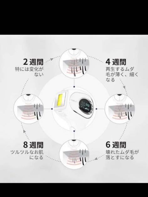 脱毛機　30万回照射回数