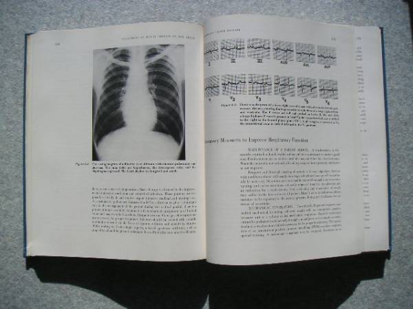 ∞　成人心疾患の治療　TREATMENT of HERT DISEASE in the ADULT　ルービン、グロス、アルビット共著 洋書　LEA & FEBIGER刊　1968年_経年傷み、焼け、シミ、スレ、汚れ有り