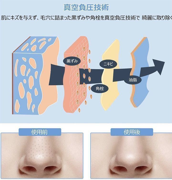 最新毛穴吸引器はここまで進化!☆最新最先端技術のHD高画質カメラを