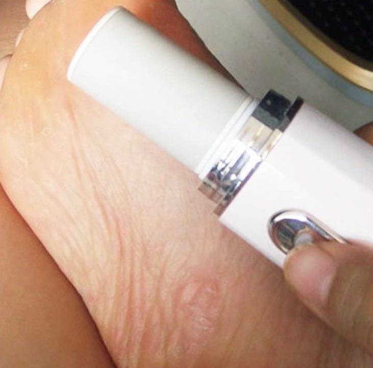 イルポリッシャー 電動 爪磨きセット ネイルケア 爪やすり 手足兼用 甘皮処理 角質ケア用 甘皮処理 角質ケア