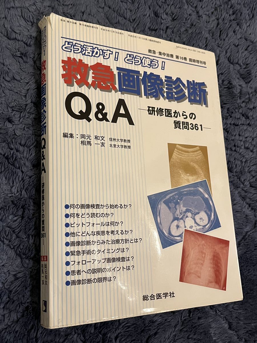 救急画像診断　Q&A 研修医からの質問361 ER 画像　救急