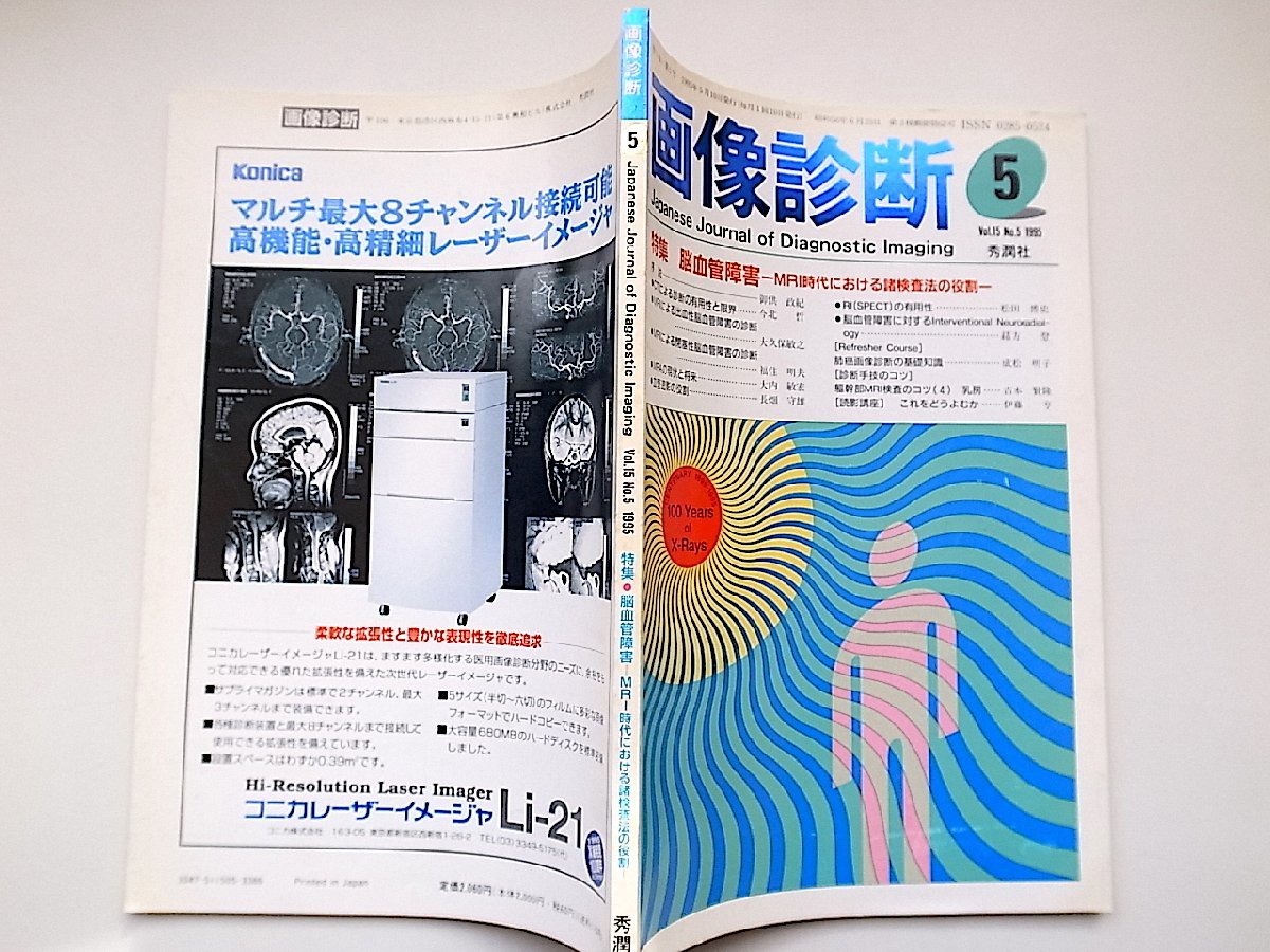 22a■　画像診断1995年5月号vol.15No.5●特集=脳血管障害ーMRI時代における諸検査法の役割_画像2