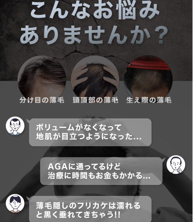 【送料無料】 瞬間増毛 CAX カックス 3本セット 薄毛 隠し ブラック 増毛スプレー ハゲ隠し 増毛ふりかけ 耐水 育毛剤 発毛剤と併用可 3