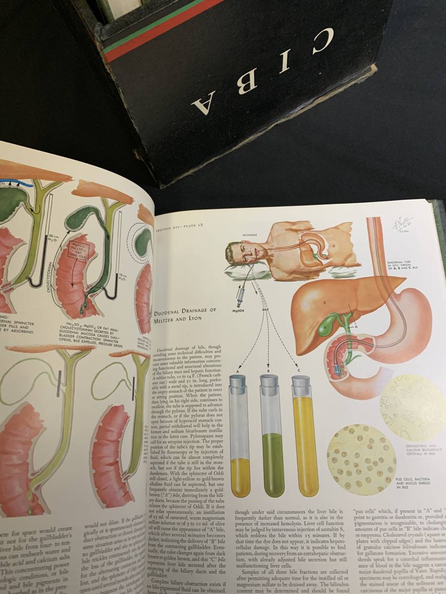 『HI 医学書 図解説 CIBA 9冊揃い COLLECTION OF MEDICAL ILLUSTRATIONS Frank H. Netter 医学洋書 専門書 』_画像6