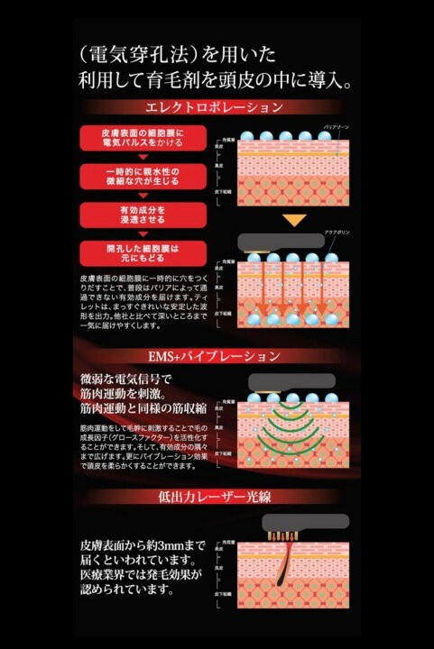 TILLET ティレット イオン導入器 美顔器(ブラック) | alfasaac.com