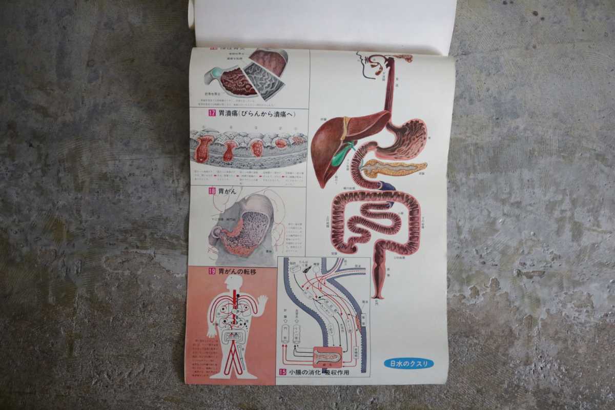 人体解剖図 アナトミカルチャート/主要臟器図 病理模型図 監修 順天堂大学医学部 病理学教授 橋本敬祐先生 日水製薬株式会社 アンティーク_画像4