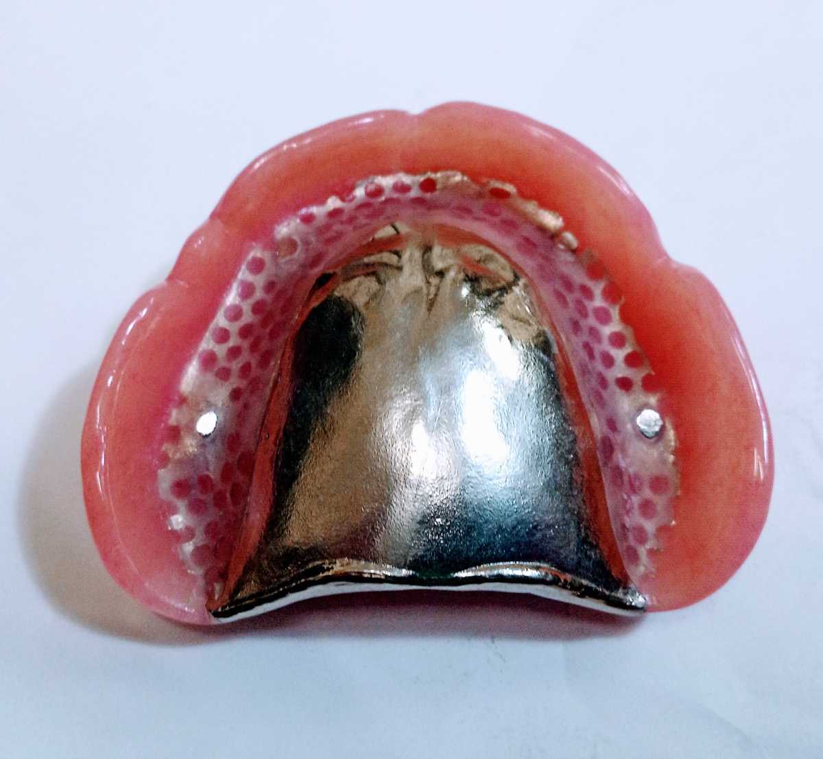 送料込み 金属床 歯科 総義歯 サンプル 見本 入れ歯 フルデンチャー