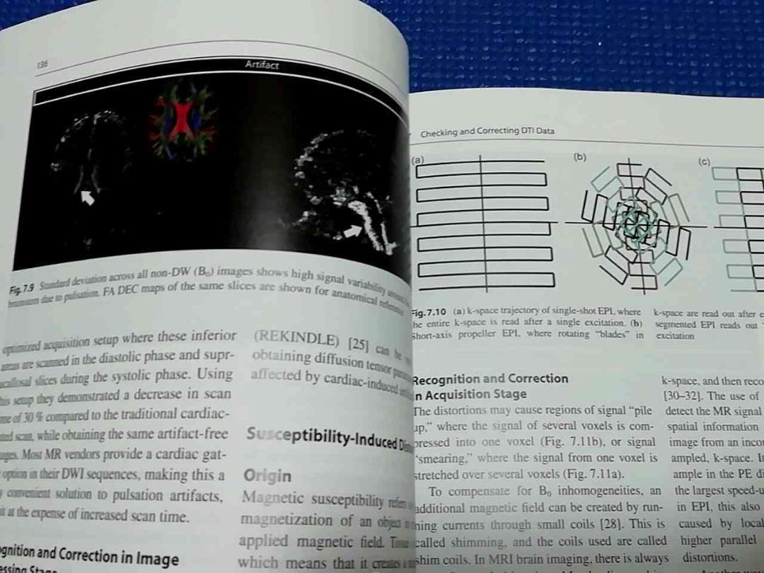 Diffusion Tensor Imaging: A Practical Handbook　拡散テンソルイメージング 実用ハンドブック 拡散テンソル画像 英語 洋書_画像2