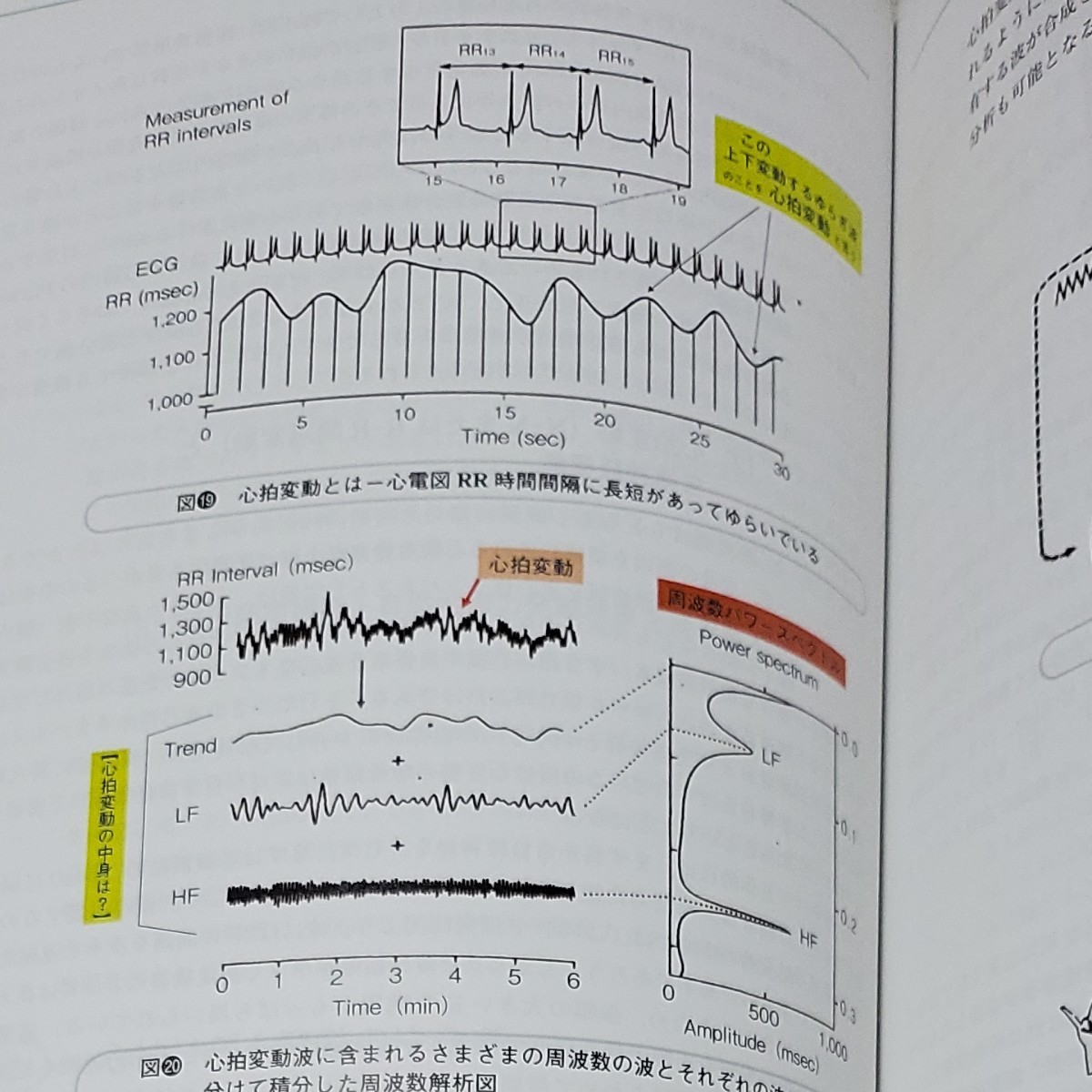 心身自律神経バランス学 体内1/fゆらぎ様現象検出 脳の情報を心電信号から読み取る/後藤幸生