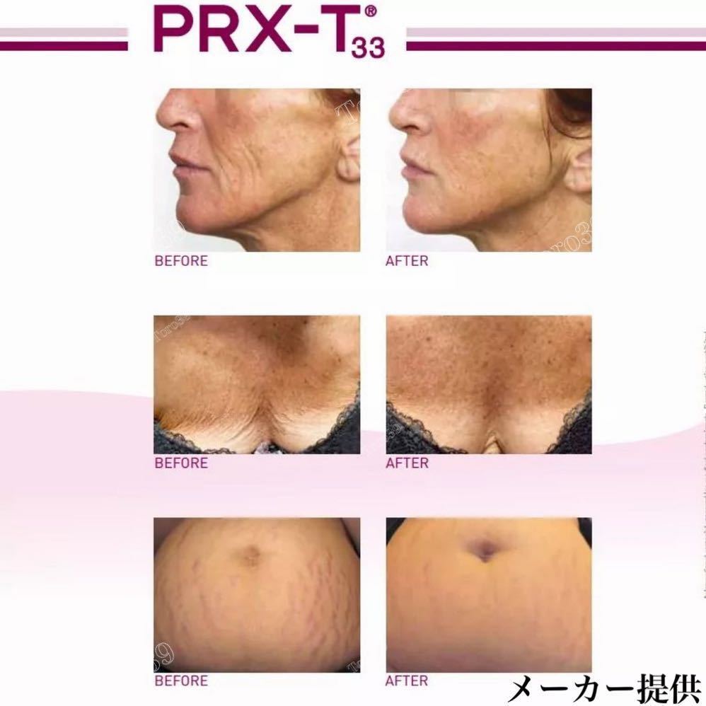 りです ヤフオク! クール便送料込み アンプル2本のみ PRX... - 大変お得 をアップし
