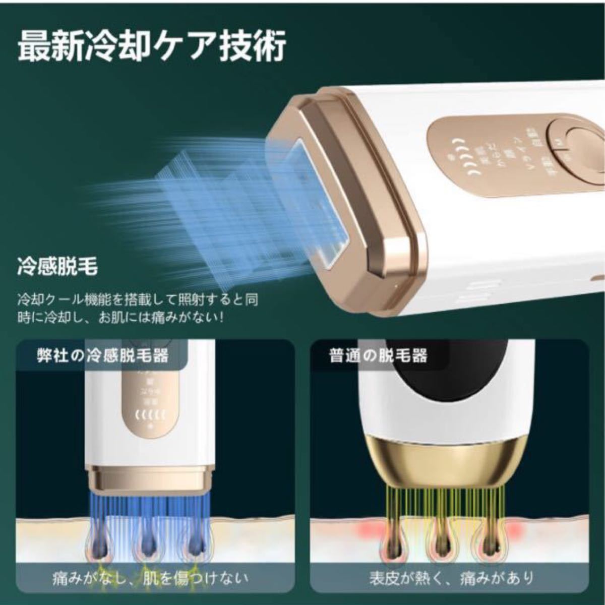 Redfire 脱毛器 冷感脱毛器 手動/自動モード 全身用 小型 軽量 家庭用