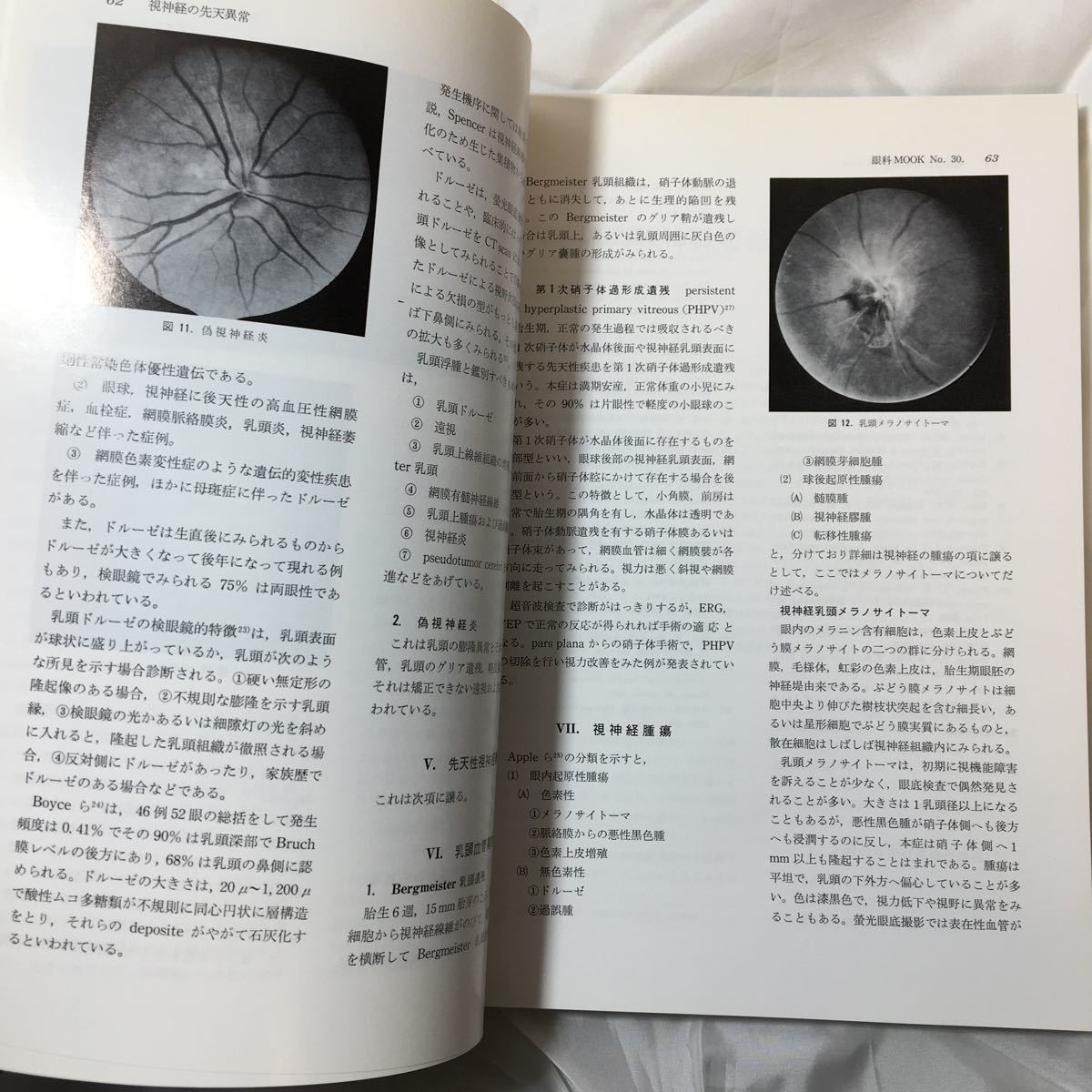zaa-317♪眼科30 眼神経とその疾患 三島済一(著) 金原出版 1986/10/30