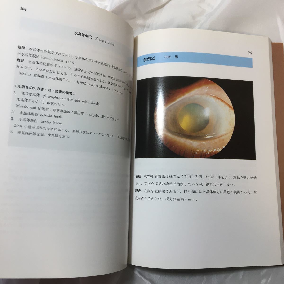 zaa-320♪眼疾患　ケース・スタディ　カラーによる診断とその解説100　丸尾敏夫(著) 1984年11月 文光堂_画像8