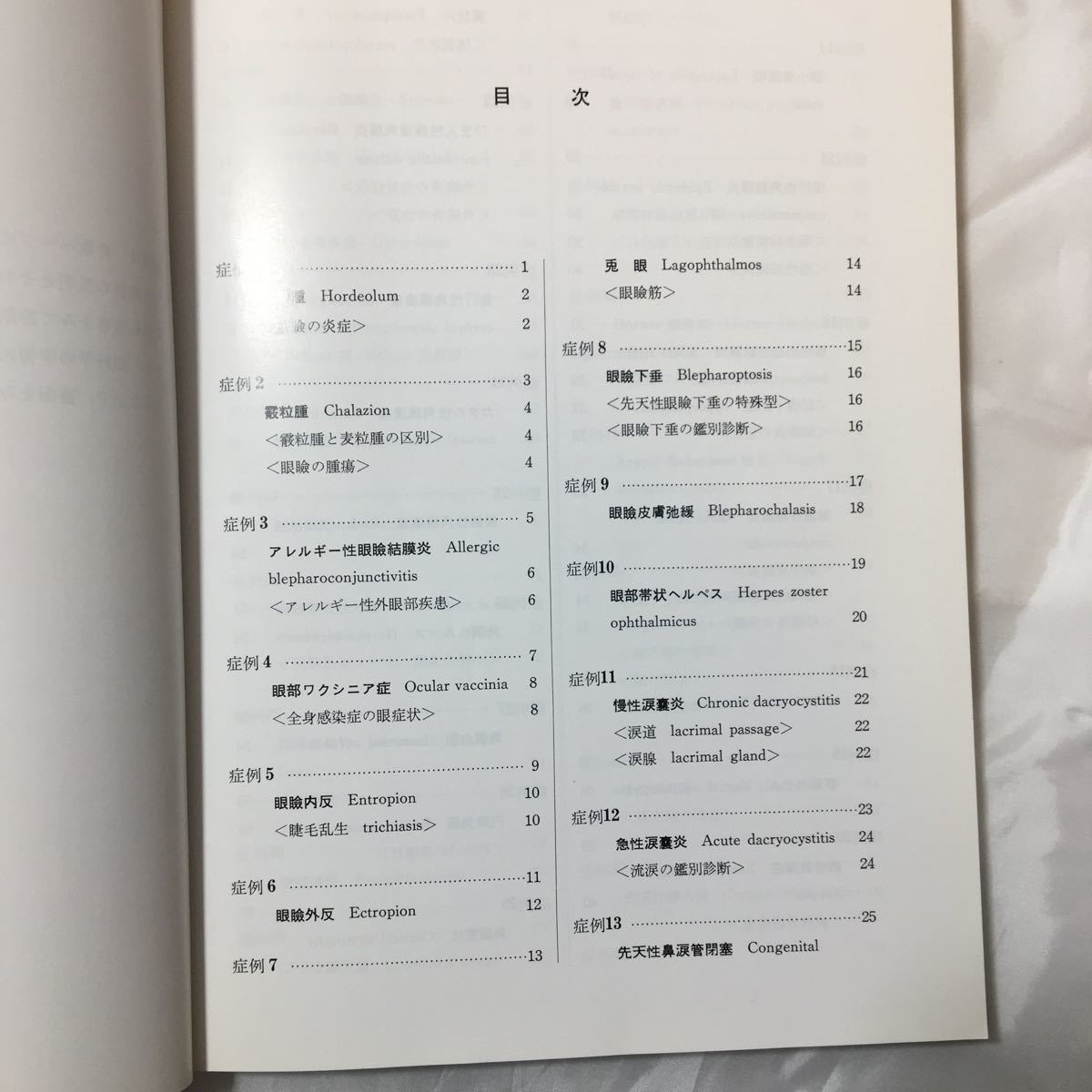 zaa-320♪眼疾患　ケース・スタディ　カラーによる診断とその解説100　丸尾敏夫(著) 1984年11月 文光堂_画像2