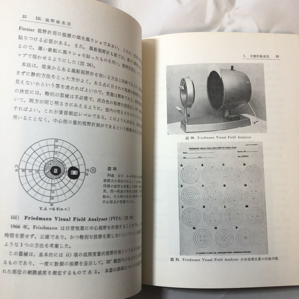 zaa-320♪視野の計り方とその判定 松尾 治亘 (著, 編集)　金原出版　単行本 1977/2/28_画像7