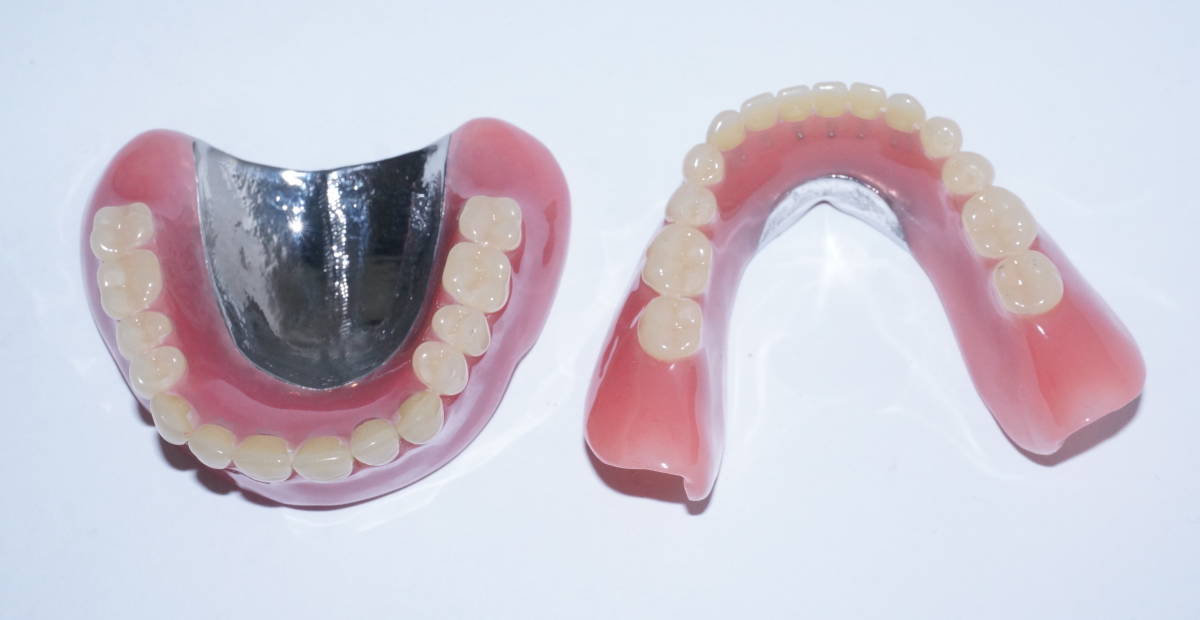 歯科 総義歯 金属床 サンプル 模型 見本 入れ歯 補綴 フルデンチャー